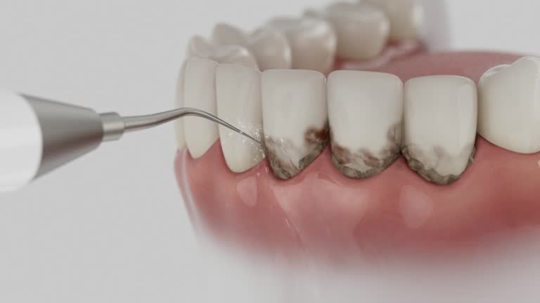 Trusted Root Canal Treatment service in Toledo, OH - Dentist Open Now
